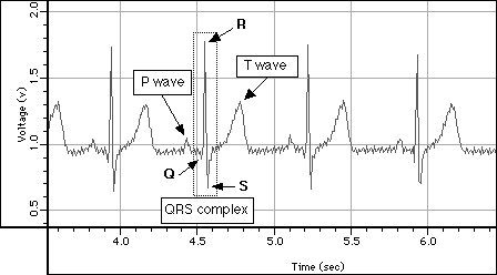example EKG